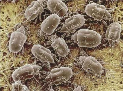 光曬棉被是殺不光螨蟲(chóng)的，教你一個(gè)輕松的方法殺滅它